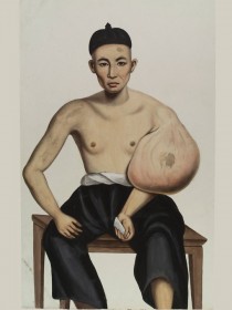 Lam Qua, Retrato médico