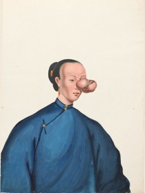 Lam Qua, Retrato médico