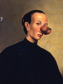Lam Qua, Retrato médico, Colección Peter Parker