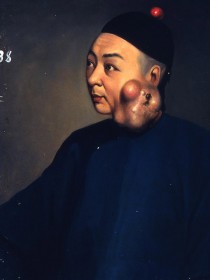 Lam Qua, Retrato médico, Colección Peter Parker